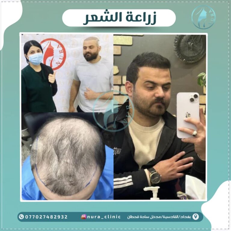 كميه الزراعة 768x767