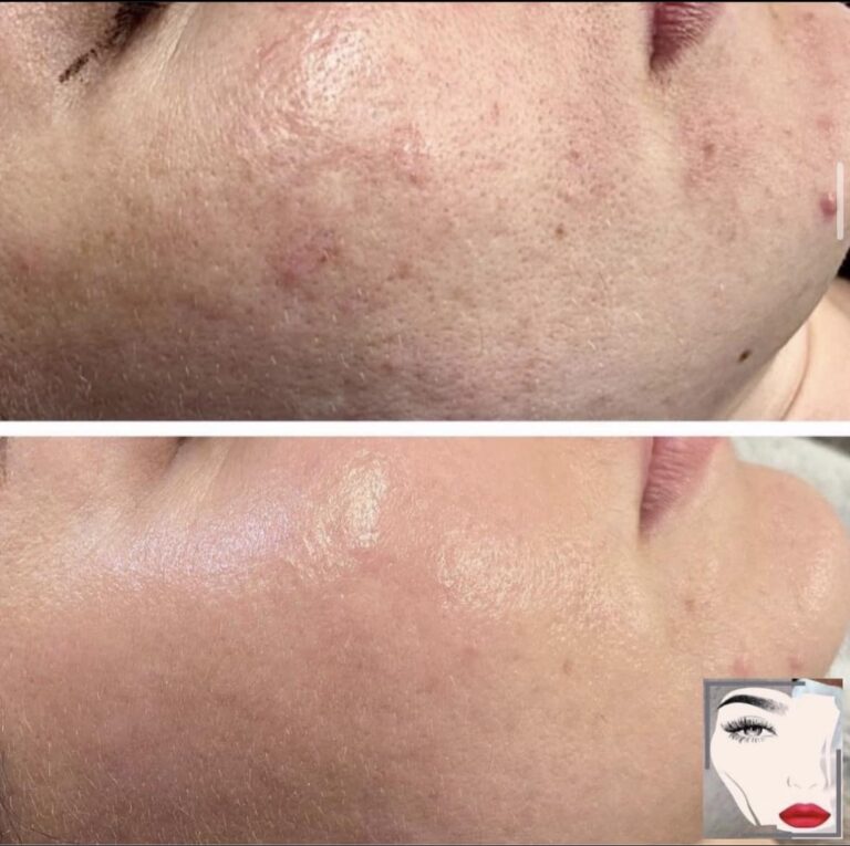 لمعان البشره 768x765