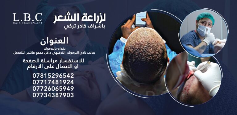 لووكو 2 768x373