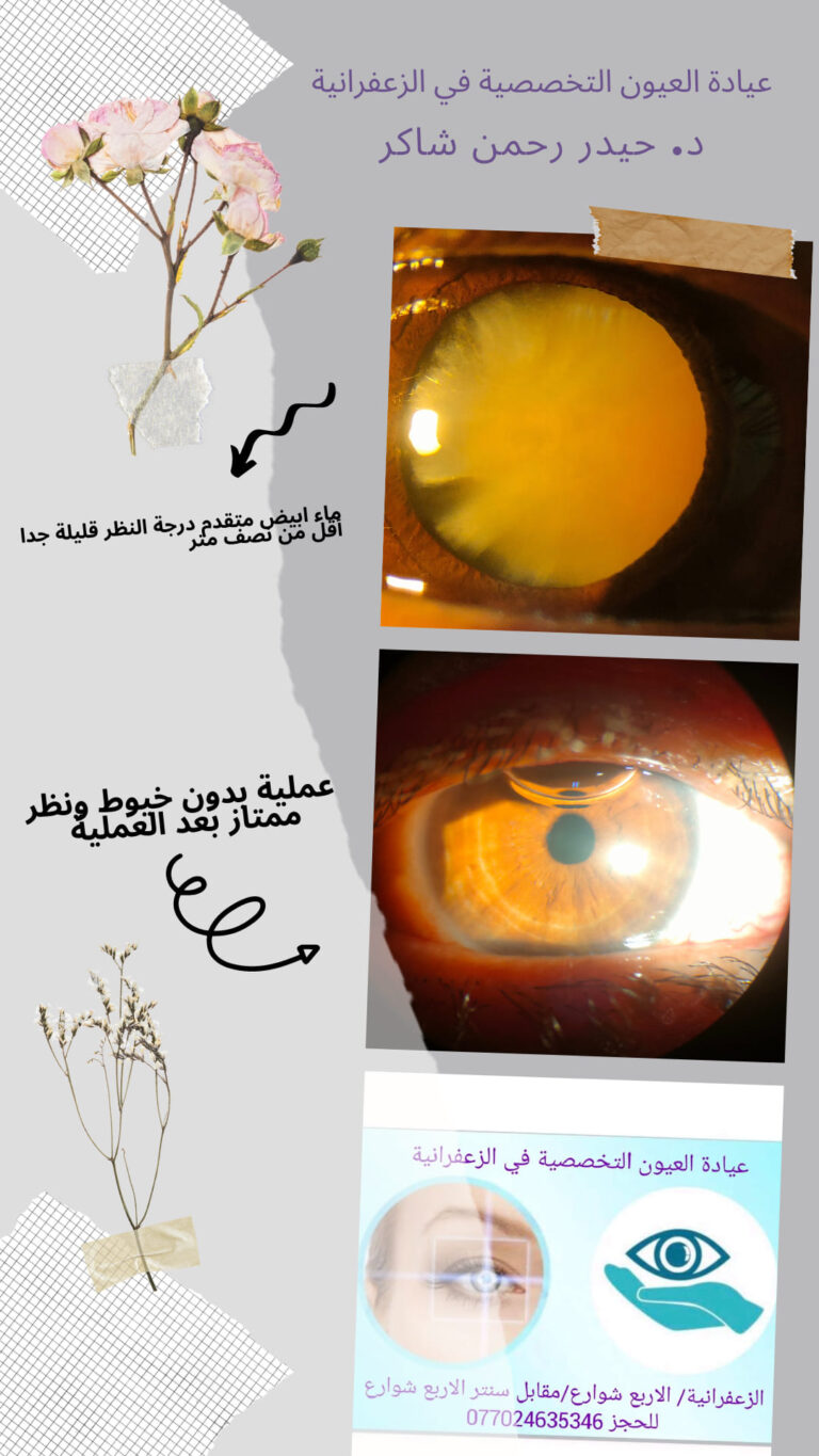 ماء الابيض 768x1365