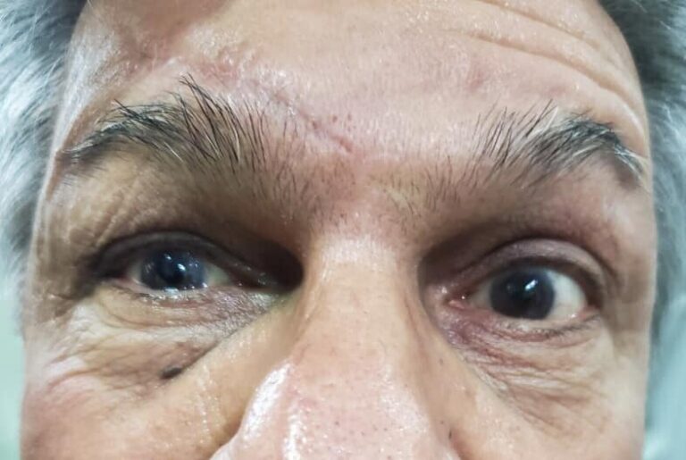 ماء العين اسود 768x515