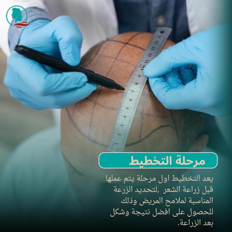 مرحله التخطيط للزراعه 768x768