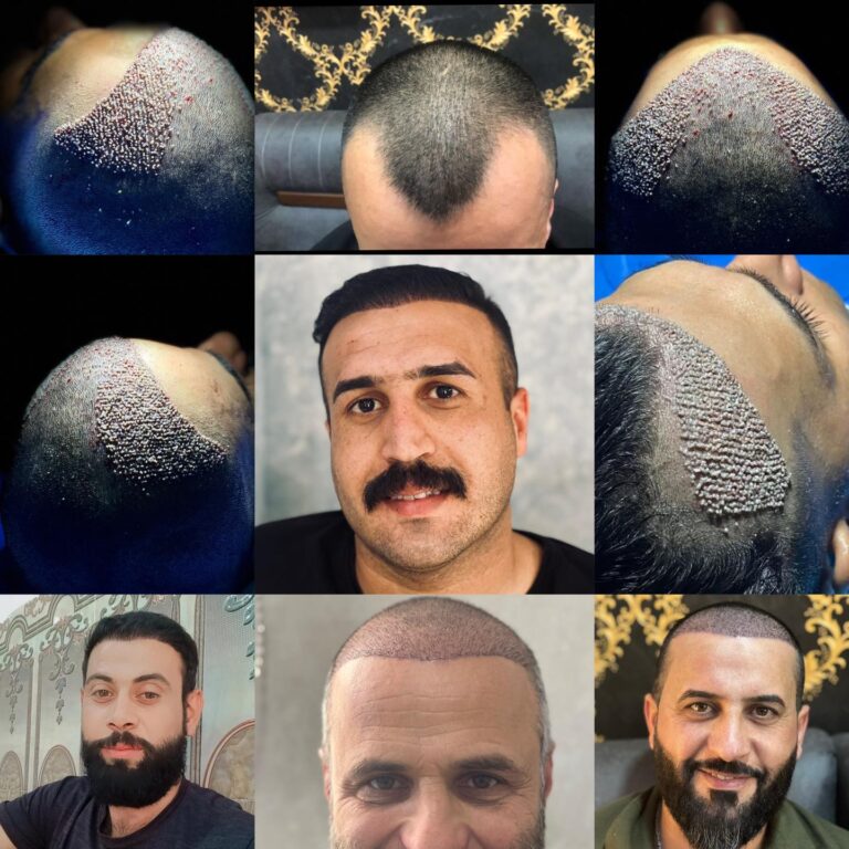 نتائج الزراعة 1 768x768