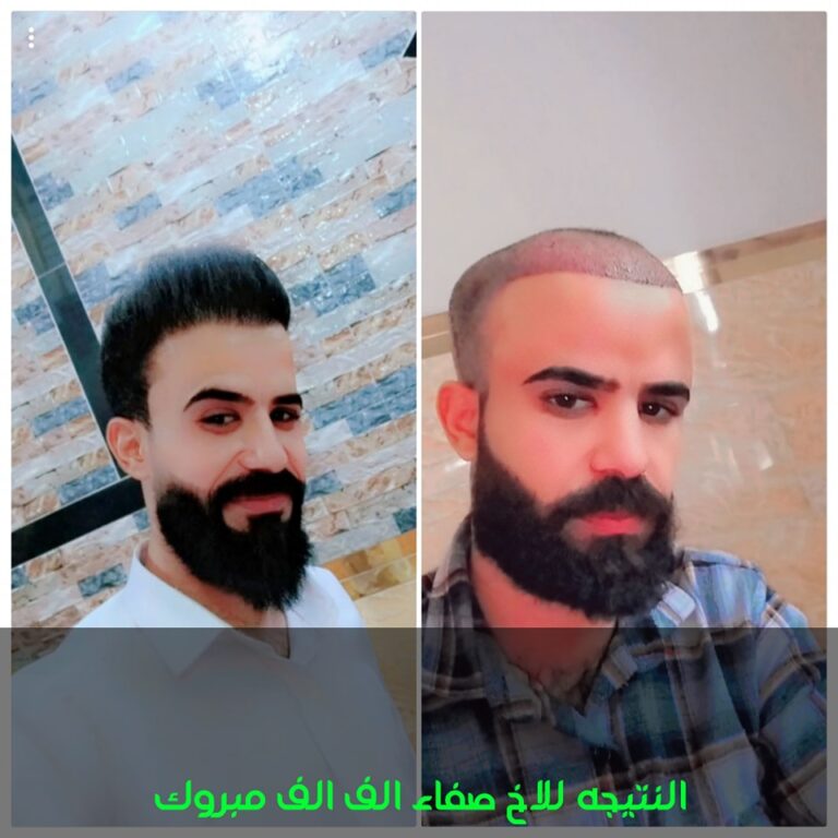 نتائج الزراعه 768x768