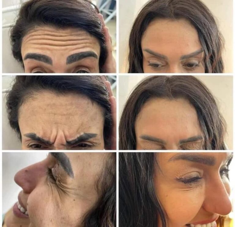 نتائج بوتكس 768x743