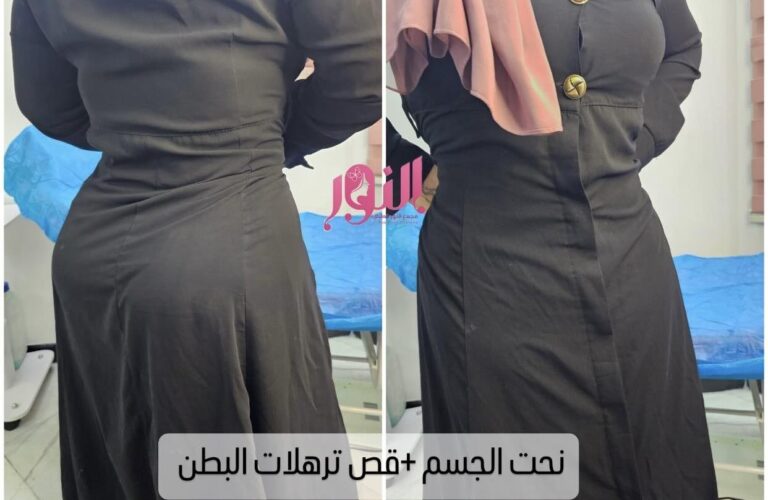 نحت الجسم والترهولات 768x500