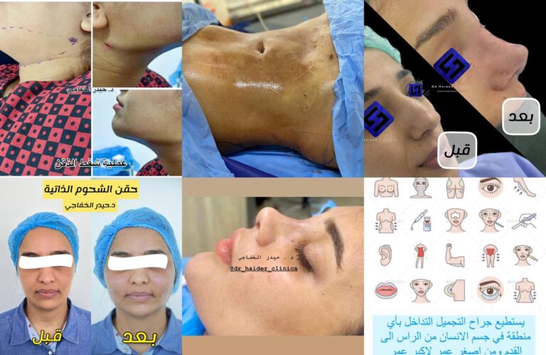 نماذج من عملنا 768x499