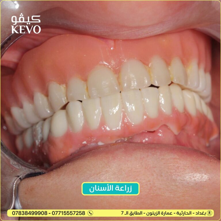 بعد الز 768x768